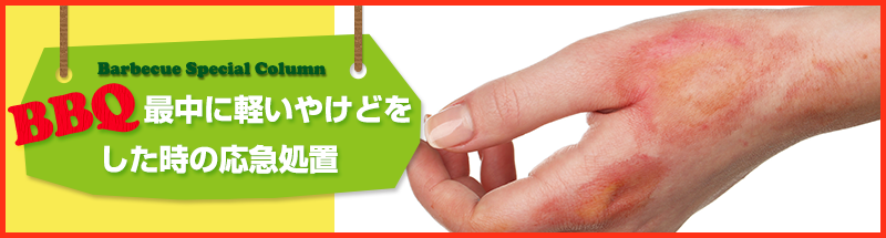 処置 やけど 天ぷら油でやけどをした時の応急処置方法はこれ！